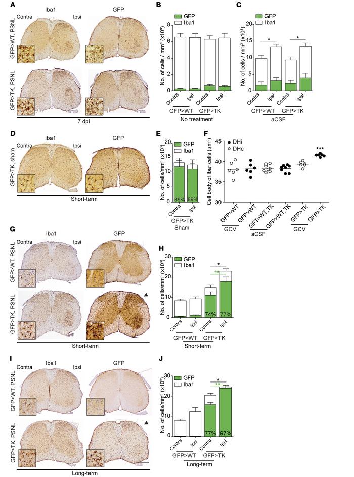 Protracted peripheral myeloid cell reactivity after PSNL in GFP>TK an...
