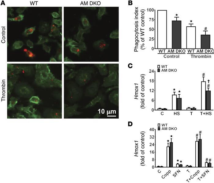 
Axl/Mertk deficiency reduces erythrophagocytosis and macrophage reparat...