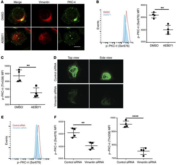 Vimentin superstructure is disrupted by PKC-θ or vimentin inhibition.
(A...