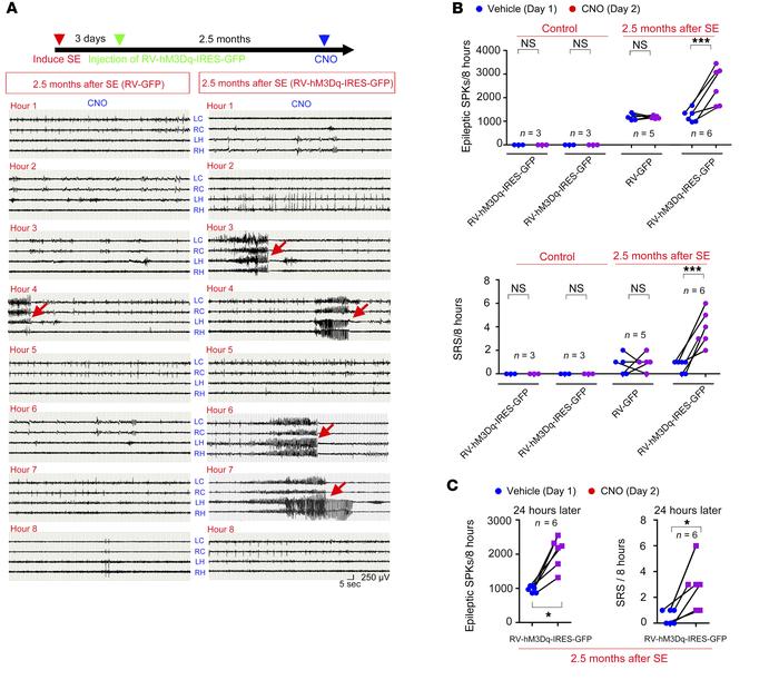 Specific activation of newborn DGCs is sufficient to induce seizures in ...