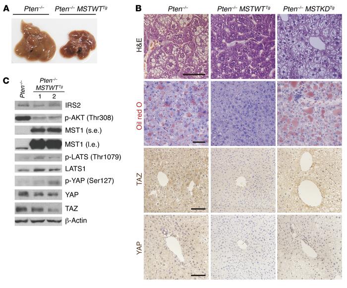 Activation of the Hippo pathway rescues the NAFLD phenotype through supp...