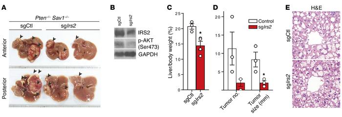 Suppression of Irs2 attenuates the development of liver tumor progressio...