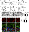 Inhibition of Jmjd3 and UTX attenuates renal injury in diabetic mice.