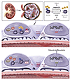 Mechanism by which histone patterning by H3K27me3 regulates podocyte differ