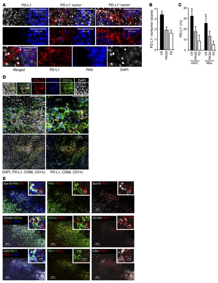 Relationship between PD-L1+ APCs and clinical response to PD-1 blockade ...