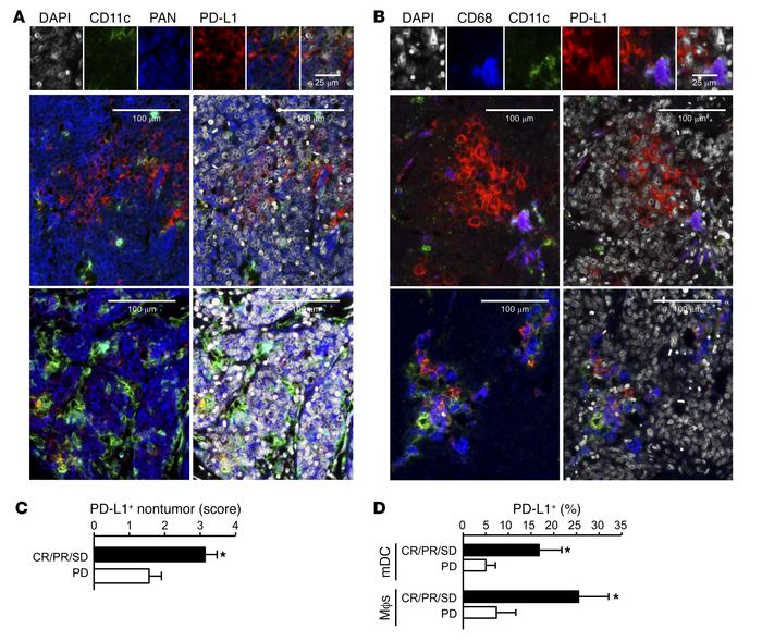 Relationship between PD-L1+ APCs and clinical response to PD-1 blockade ...