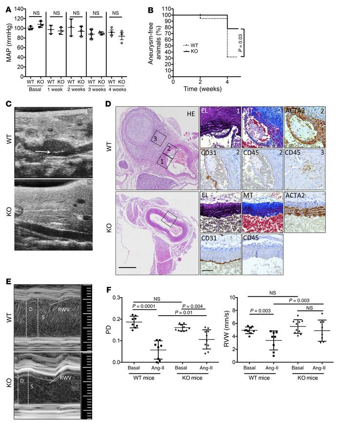 Effects of Uhrf1 absence in vivo.
(A) Mean arterial blood pressure (MAP)...