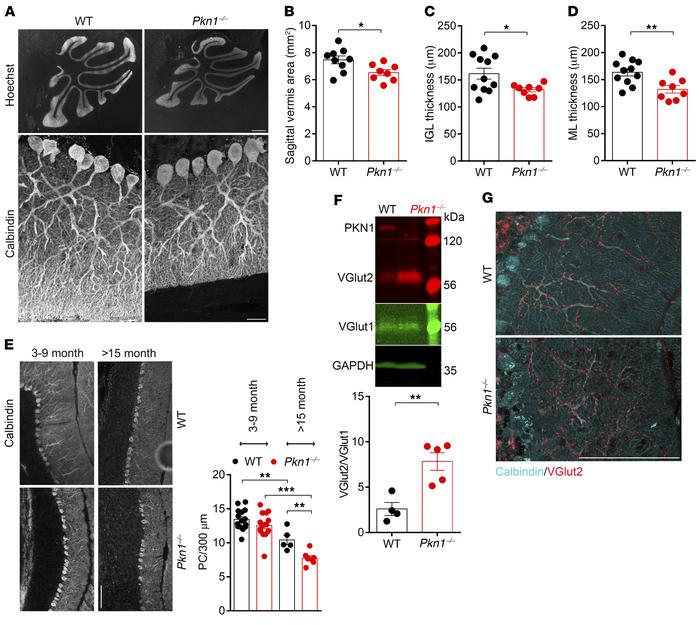 Adult Pkn1–/– mice show cerebellar shrinkage and late-onset PC degenerat...