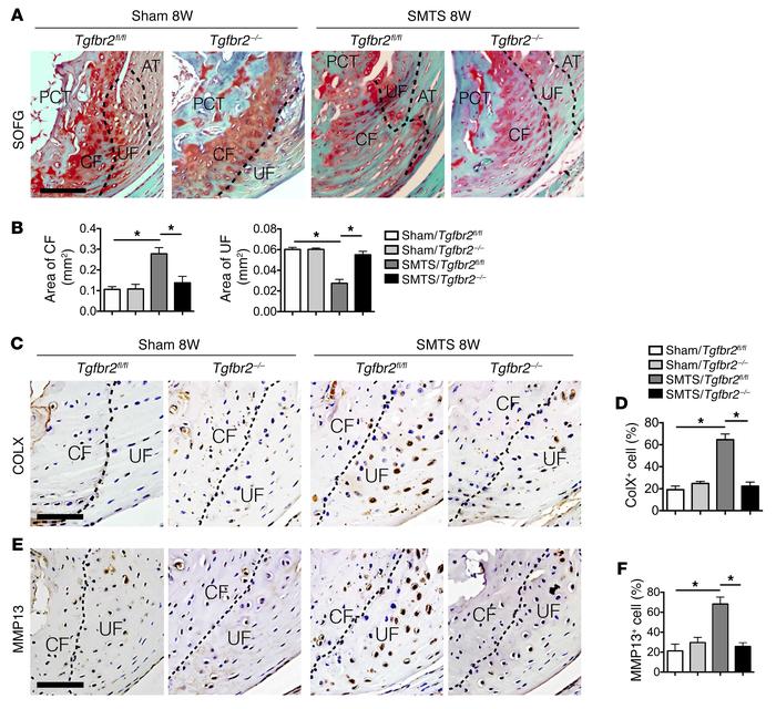 Deletion of Tgfbr2 in Nestin+ cells mitigates enthesis degradation in en...