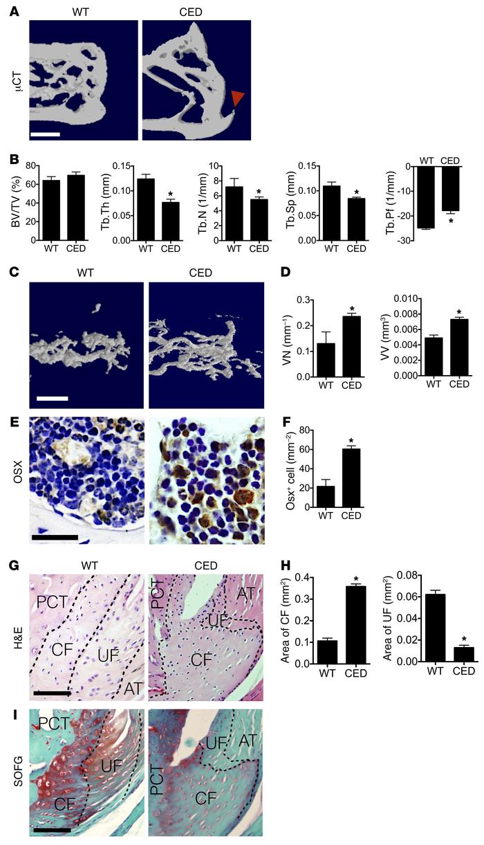 CED mice show an Achilles tendon enthesopathy phenotype.
(A) μCT images ...