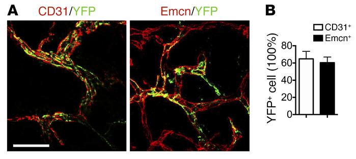 Nestin+ cells gives rise to vesselsin PCT bone marrow after SMTS.
(A, le...