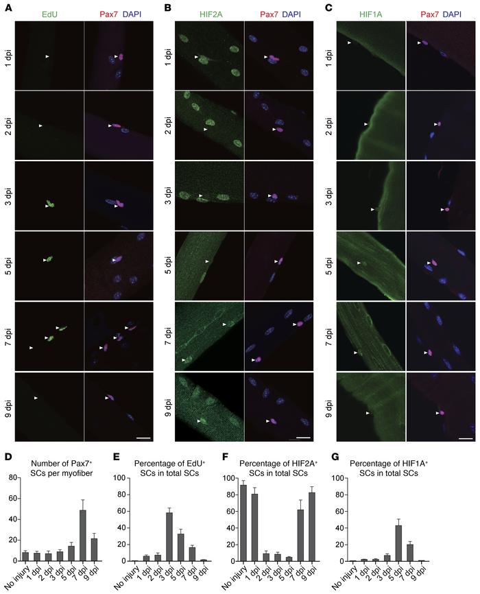 Muscle repair following eccentric contraction–induced injury is concomit...