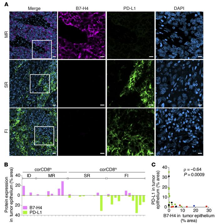 TIME TNBC subtypes display mutual exclusion and distinct localization of...