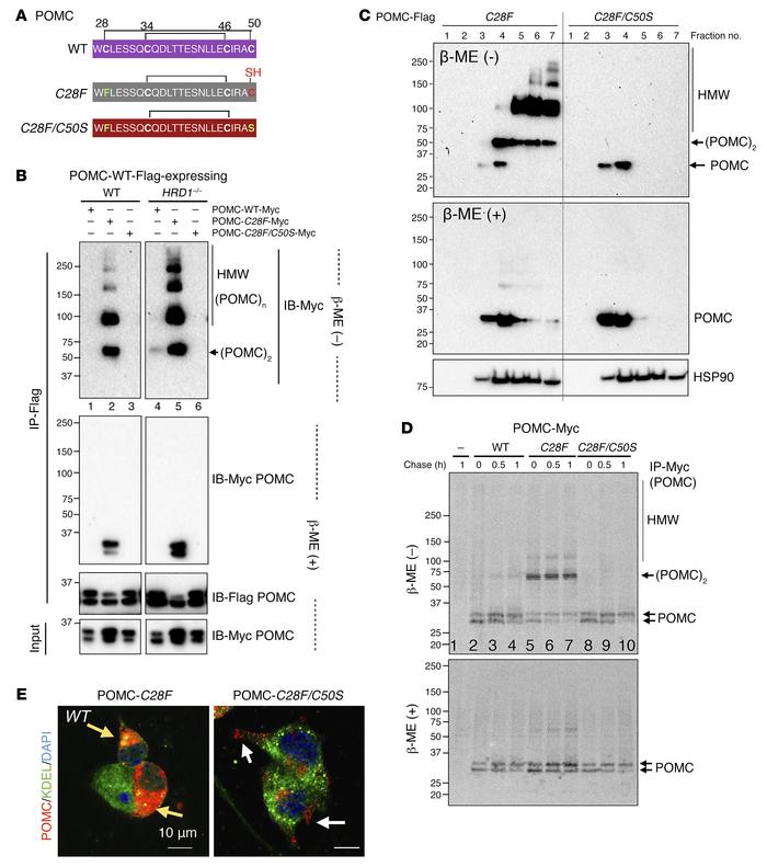 Pathogenic POMC-C28F mutation is completely rescued by an intragenic sup...