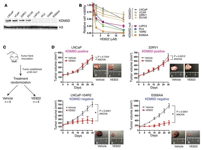 Higher sensitivity of ATR inhibitor to PC cells deficient in KDM5D in an...