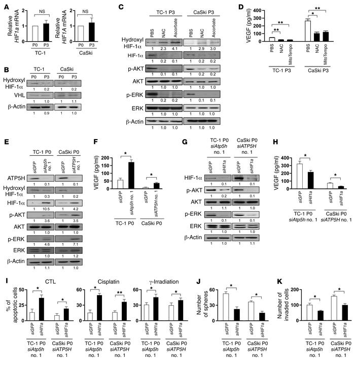 Loss of ATP5H underlies aberrant activation of the HIF-1α/AKT/ERK signal...