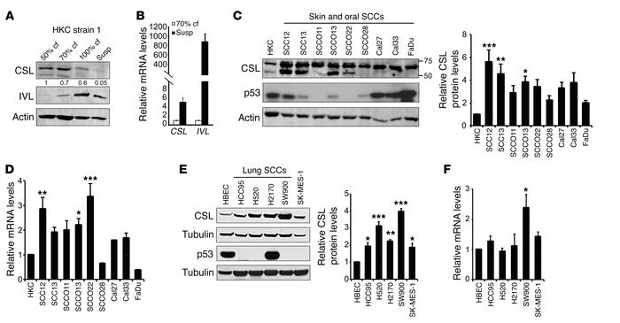 Higher CSL expression in proliferating vs. differentiating keratinocytes...