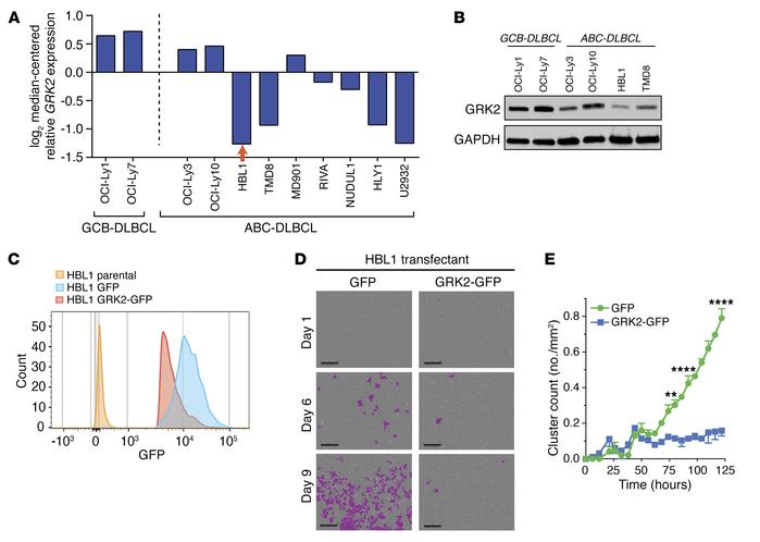 Overexpression of GRK2 inhibits ABC-DLBCL proliferation.
(A) HBL1 cells ...