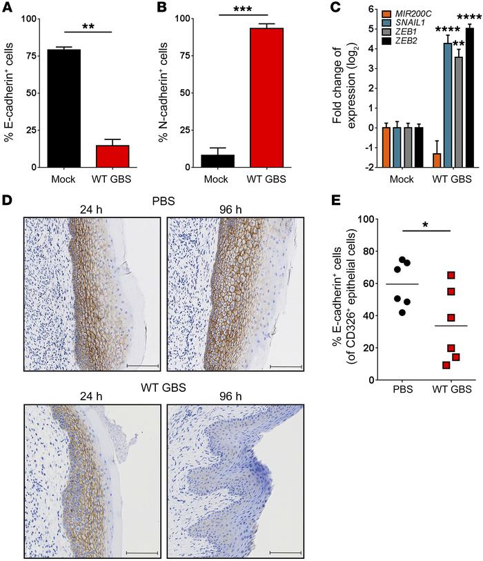 GBS induces EMT.
Flow cytometric analysis of surface E-cadherin (A) or N...