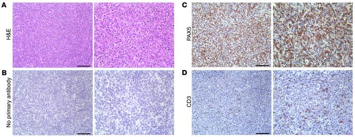Aged vPK transgenic mouse lymphomas are composed predominantly of B cell...