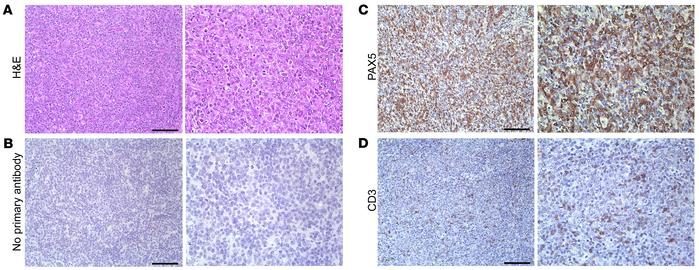 Aged vPK transgenic mouse lymphomas are composed predominantly of B cell...