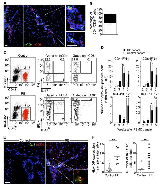 Cytokine production by hCD4+ and hCD8+ T lymphocytes infiltrating the CN...