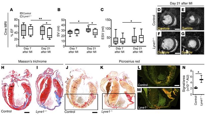 Disruption of LYVE-1–dependent clearance of immune cells by lymphatics i...