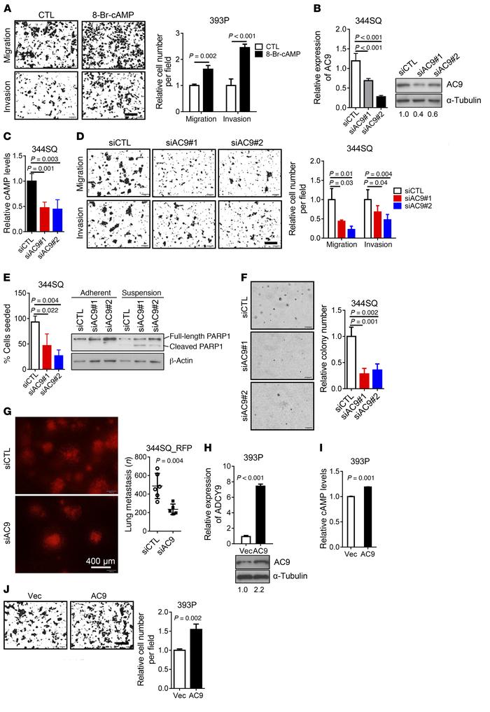 AC9 is essential for EMT-driven metastasis.
(A) Boyden chamber assays of...