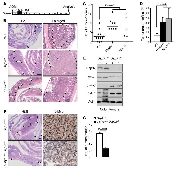 Usp9x suppresses CRC.
(A) Schematic of AOM/DSS-induced CRC model. (B) H&...