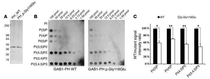 GAB1 harboring the p.Gly116Glu substitution has reduced binding affinity...