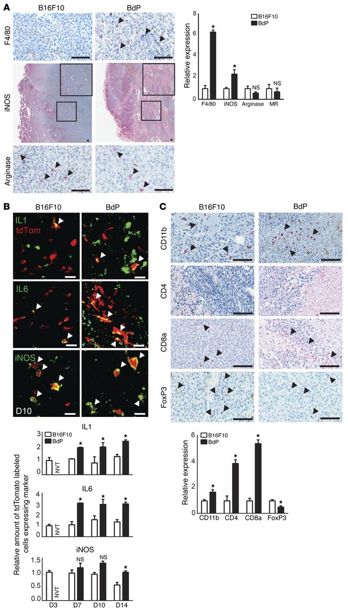 Pros1 inhibits M1 polarization and reduces immune infiltrate in vivo.
(A...