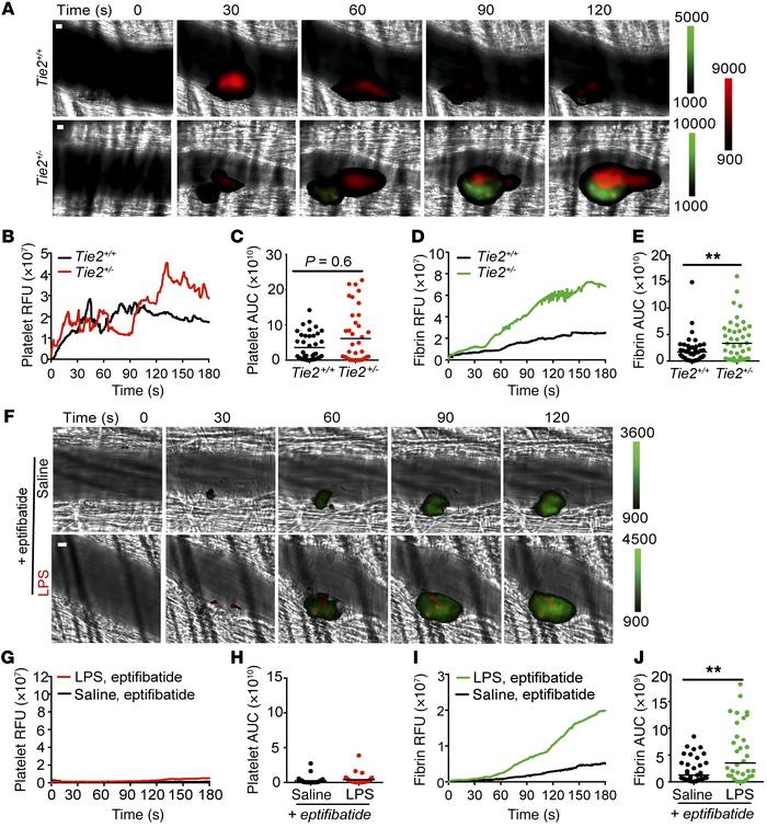 Tie2 deficiency alone recapitulates sepsis-associated thrombotic respons...