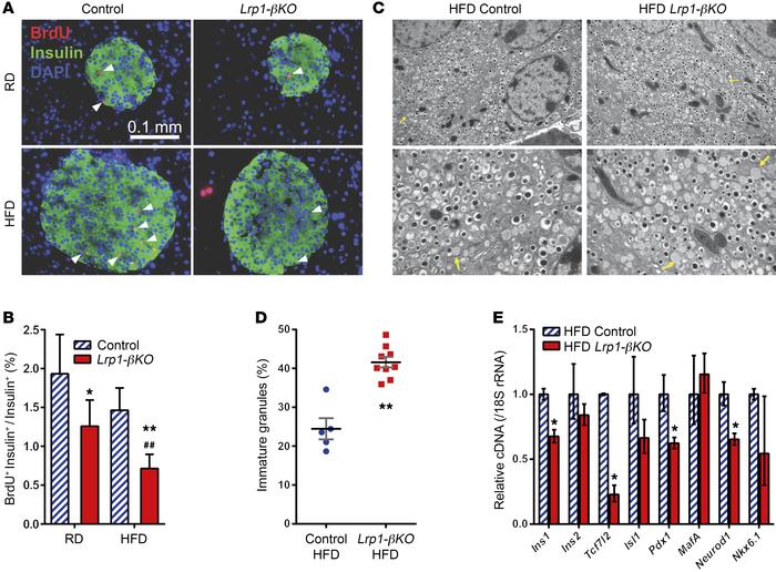 Defective proliferation and insulin production in LRP1-KO β cells after ...