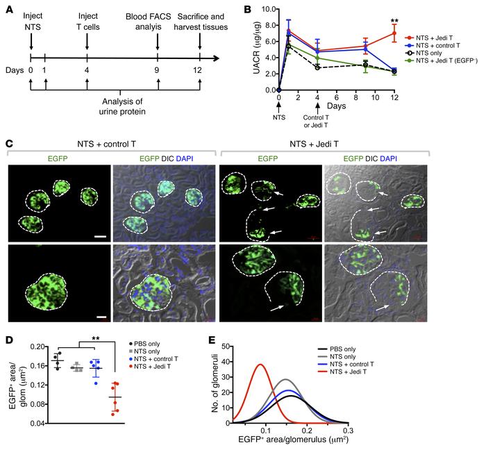 Effects of Jedi T cell injections in the setting of NTSN.
(A) Time cours...