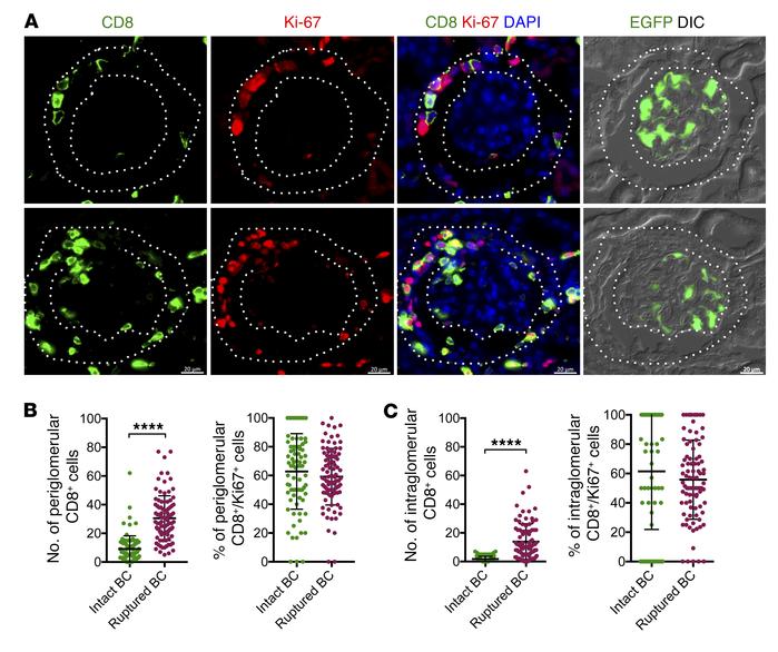 Effects of BC rupture on the distribution of proliferating CD8+ T cells....