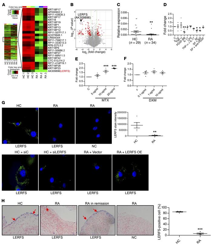 Decreased levels of LERFS lncRNA in FLSs and STs from patients with RA.
...