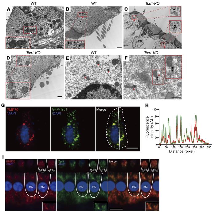 Peroxisomes are involved in the regulation of mTORC1 in inner ear hair c...
