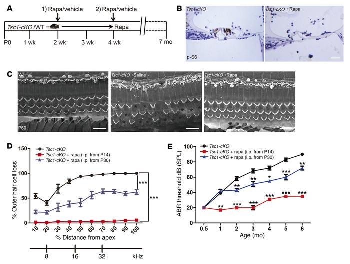 Rapamycin treatment prevents the hearing loss phenotype in Tsc1-cKO mice...