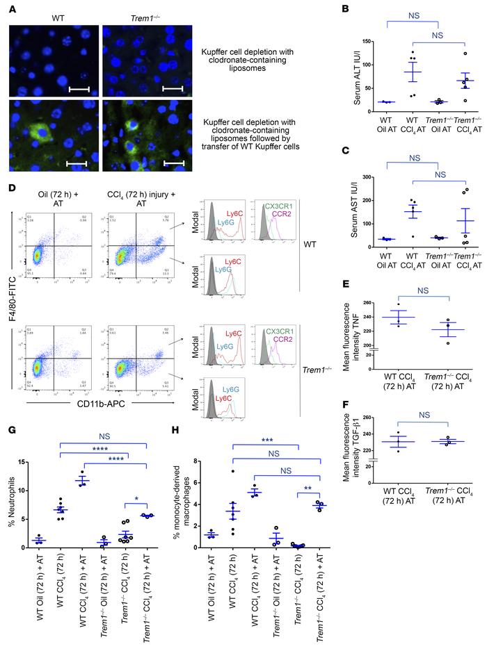 Adoptive transfer of Kupffer cells from WT mice increases liver injury a...