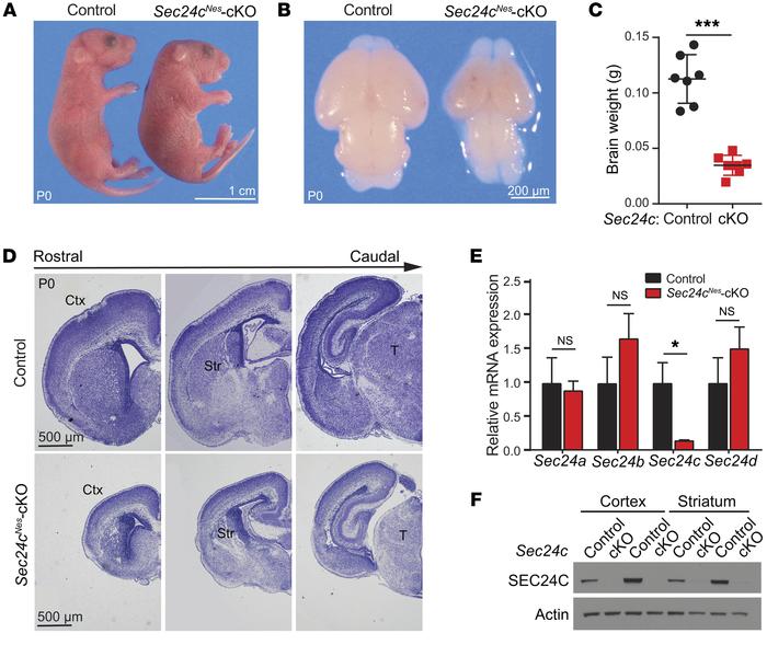 CNS-specific deletion of Sec24c leads to microcephaly.
(A) Representativ...