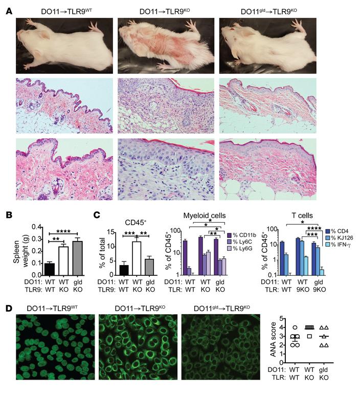 FasL-deficient DO11 T cells fail to induce skin lesions.
DO11 or DO11gld...