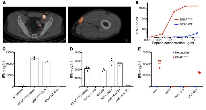 CD4+ T cells specific for BRAFV600E isolated from post–TIL infusion PBMC...