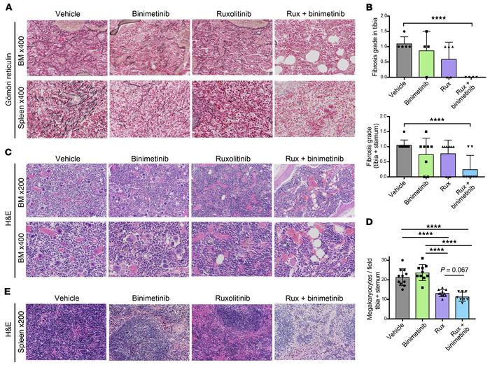 Combined JAK2/MEK inhibition reduces BM hypercellularity and fibrosis.
(...