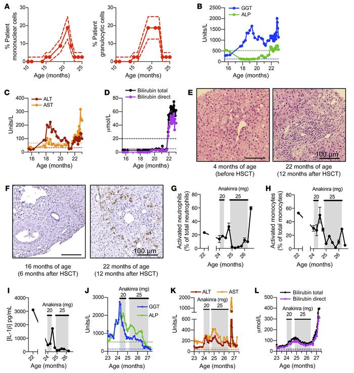 Post-HSCT deterioration and disease amelioration by IL-1β–targeting anak...