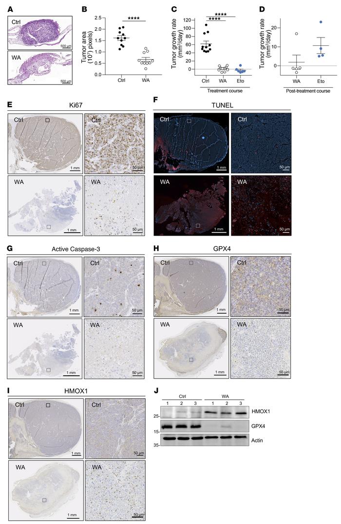 WA-eradicated high-risk neuroblastoma tumors show decreased GPX4 express...