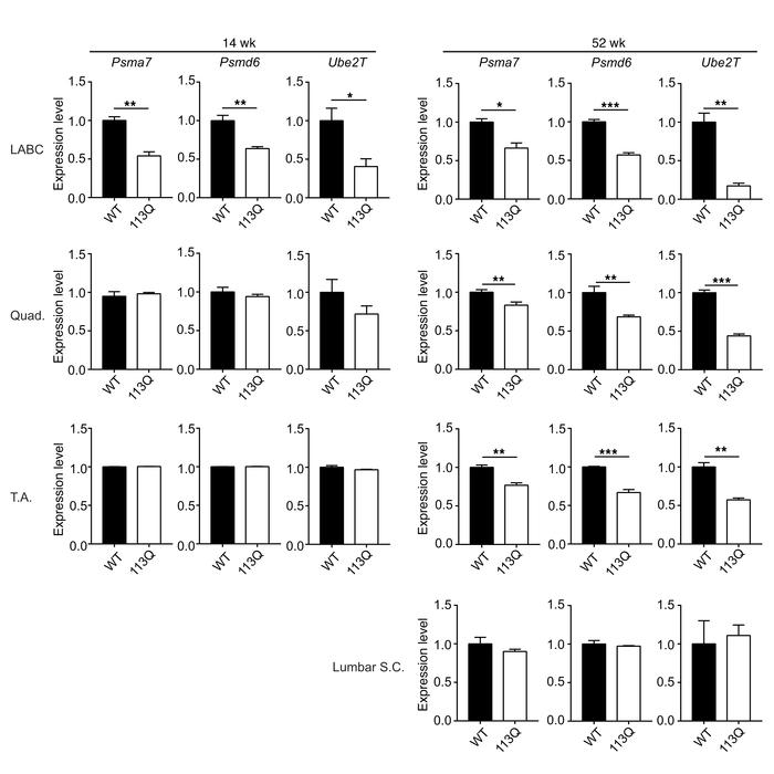 Decreased expression of ubiquitin/proteasome pathway genes is age depend...
