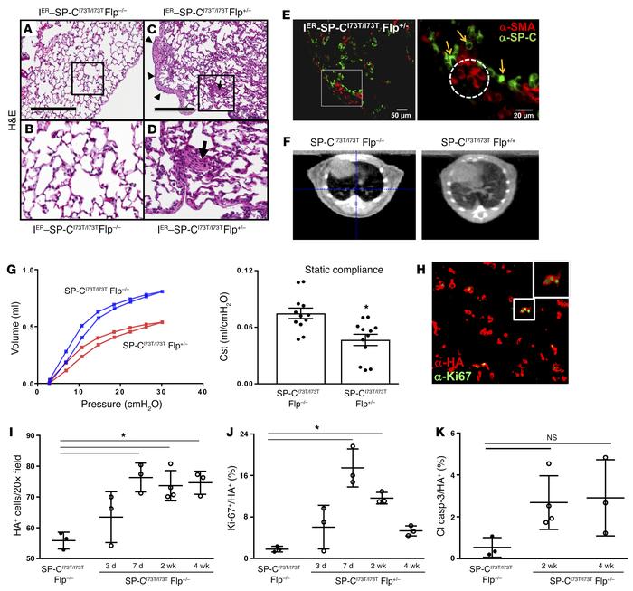 
SftpcI73T expression induces diffuse parenchymal lung remodeling, restr...