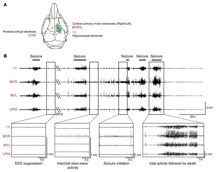 Epileptic activity of adult Depdc5fKO mice.
(A) Schematic representation...