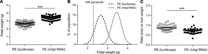 siRNA against hAgt improves fetal outcome.
(A) Fetal weights were increa...