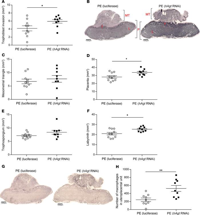 siRNA against hAgt improves placenta morphology.
(A) Extension of tropho...